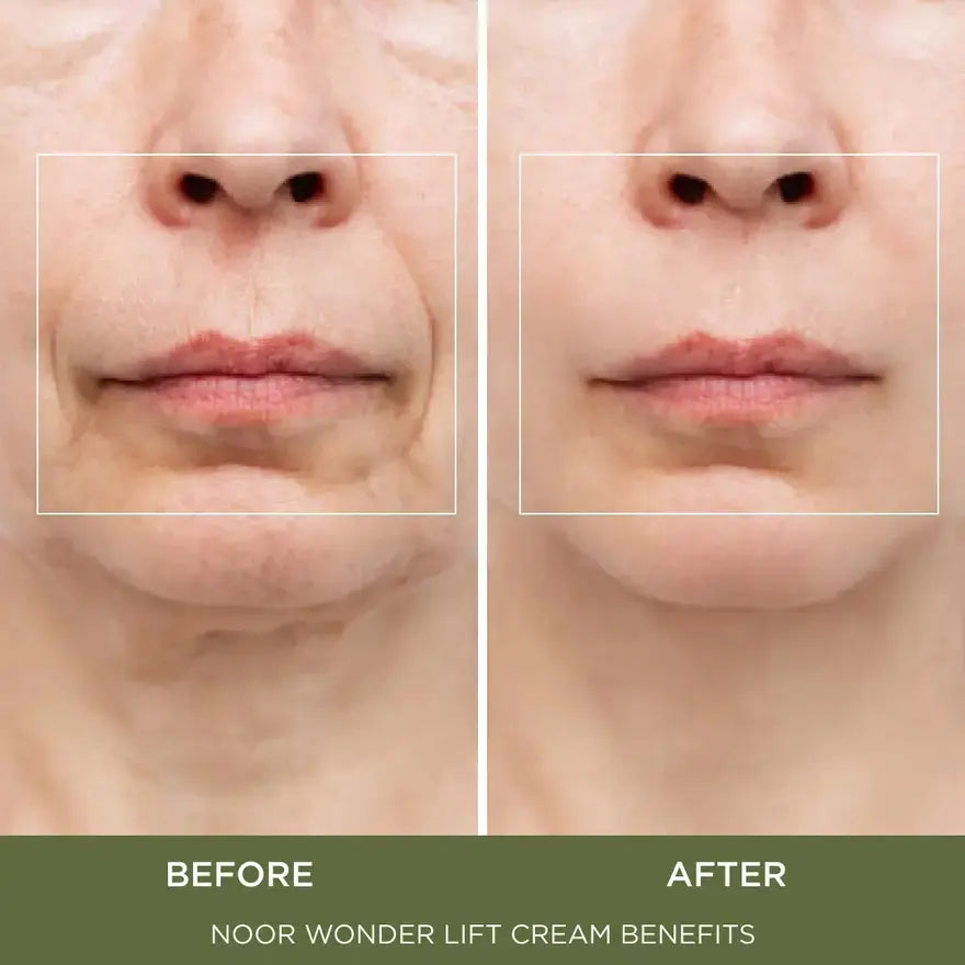Calistae™ WonderLift Cream