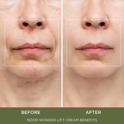 Calistae™ WonderLift Cream
