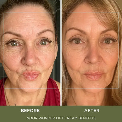 Calistae™ WonderLift Cream